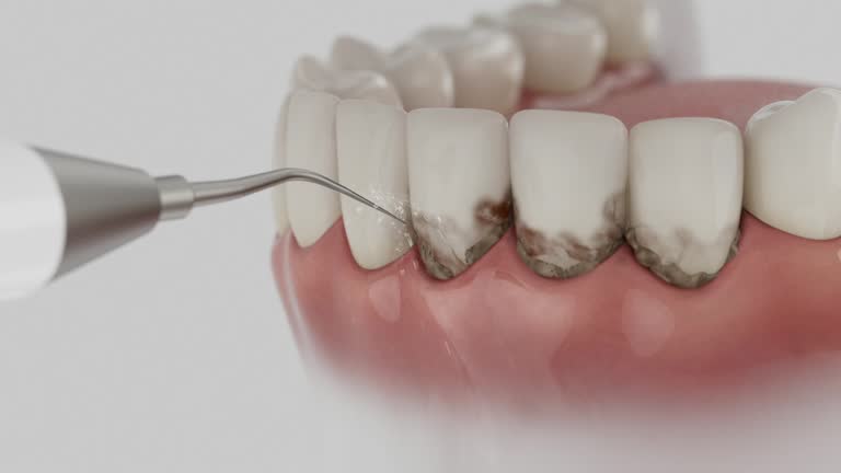 Reliable Dental Implants contractor in Beverly, OH by Smile Center Dentistry
